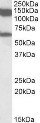 Western Blot: AF10 Antibody [NBP1-49867]