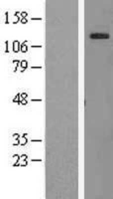 Western Blot: AF10 Overexpression Lysate [NBL1-13135]