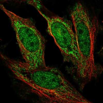 Immunocytochemistry/ Immunofluorescence: AF4 Antibody [NBP2-56873]