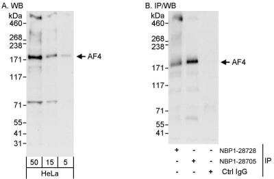 Western Blot: AF4 Antibody [NBP1-28728]