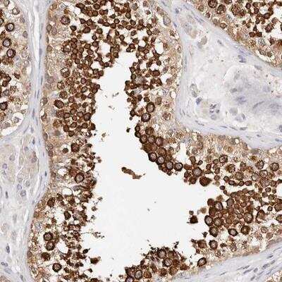 Immunohistochemistry: Afadin/AF-6 Antibody [NBP1-90221]