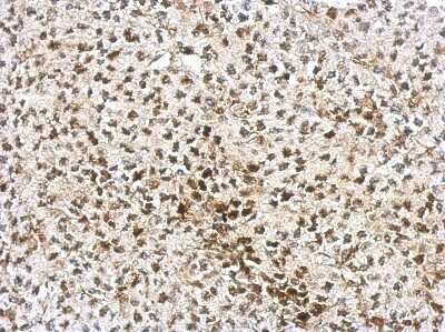 Immunohistochemistry-Paraffin: AF9 Antibody [NBP2-15303]