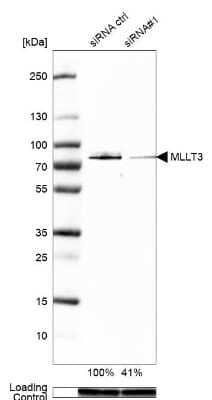 Western Blot: AF9 Antibody [NBP1-90217]