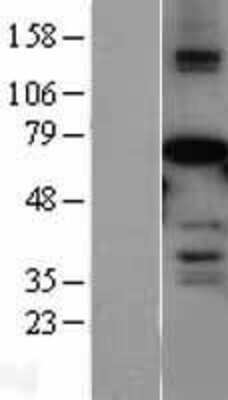 Western Blot: AF9 Overexpression Lysate [NBL1-13137]