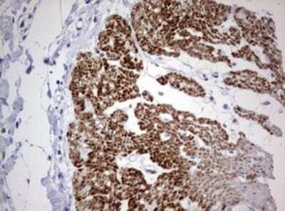 Immunohistochemistry: AFAP Antibody (OTI2G9) [NBP2-46498]