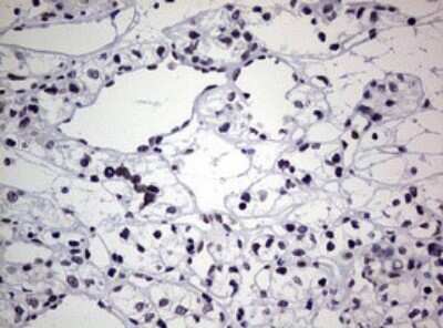 Immunohistochemistry: AFAP Antibody (OTI2G9) [NBP2-46498]