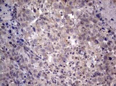 Immunohistochemistry: AFAP Antibody (OTI2G9) [NBP2-46498]