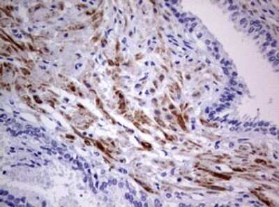 Immunohistochemistry: AFAP Antibody (OTI2G9) [NBP2-46498]