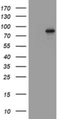 Western Blot: AFAP Antibody (OTI2G9) [NBP2-46498]