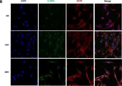 Immunocytochemistry/ Immunofluorescence: AFAP Antibody [NBP1-90216]