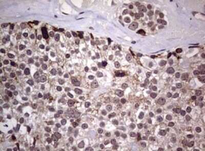 Immunohistochemistry: AFAP Antibody (OTI2G9) - Azide and BSA Free [NBP2-72120]