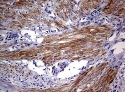 Immunohistochemistry: AFAP Antibody (OTI2G9) - Azide and BSA Free [NBP2-72120]