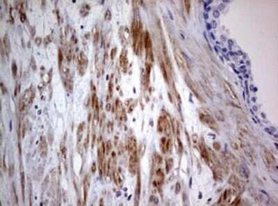 Immunohistochemistry: AFAP Antibody (OTI2G9) - Azide and BSA Free [NBP2-72120]