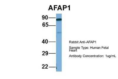 Western Blot: AFAP Antibody [NBP1-56581]