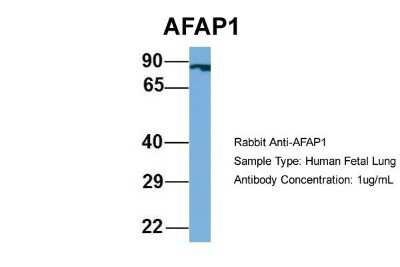 AFAP Antibody - BSA Free (NBP1-56581) by Novus, Part of Bio-Techne