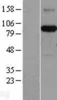 Western Blot: AFAP Overexpression Lysate [NBL1-07367]