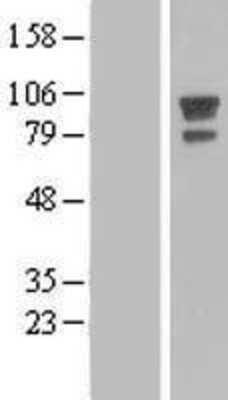 Western Blot: AFAP Overexpression Lysate [NBL1-07368]