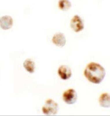 Immunocytochemistry/ Immunofluorescence: AFAP1L1 Antibody - BSA Free [NBP2-81889]