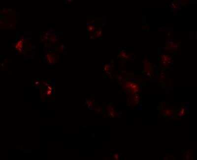 Immunocytochemistry/ Immunofluorescence: AFAP1L1 Antibody - BSA Free [NBP2-81889]