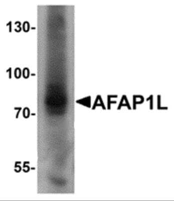 Western Blot: AFAP1L1 AntibodyBSA Free [NBP2-81889]