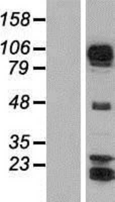 Western Blot: AFAP1L1 Overexpression Lysate [NBP2-05380]