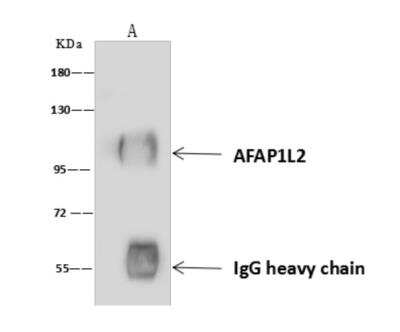 Immunoprecipitation: AFAP1L2 Antibody [NBP3-06316]