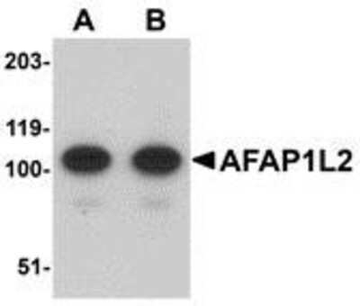 Western Blot: AFAP1L2 AntibodyBSA Free [NBP1-77358]