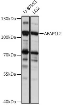 Western Blot: AFAP1L2 AntibodyAzide and BSA Free [NBP2-92280]