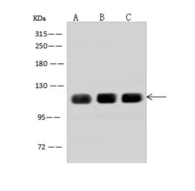 Western Blot: AFAP1L2 Antibody [NBP3-06316]