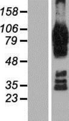 Western Blot: AFAP1L2 Overexpression Lysate [NBP2-09935]