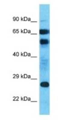 Western Blot: AFDN-DT Antibody [NBP3-09222]