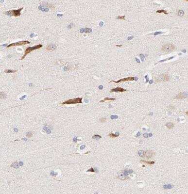 Immunohistochemistry-Paraffin: AFF2 Antibody [NBP1-81872]