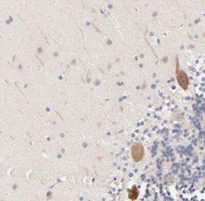 Immunohistochemistry-Paraffin: AFF2 Antibody [NBP1-81872]