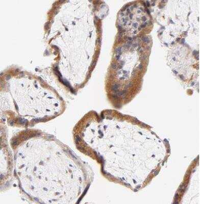 Immunohistochemistry-Paraffin: AFF2 Antibody [NBP1-81872]