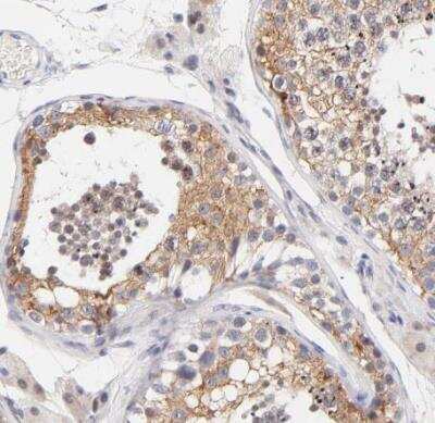 Immunohistochemistry-Paraffin: AFF2 Antibody [NBP1-81872]