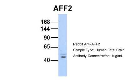 Western Blot: AFF2 Antibody [NBP2-84403]