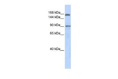 Western Blot: AFF2 Antibody [NBP2-84404]