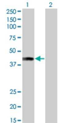 Western Blot: AFF4 Antibody (2E12) [H00027125-M01]