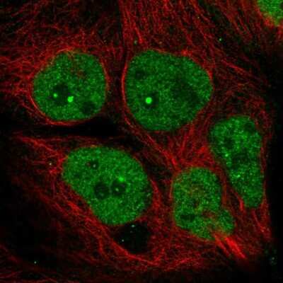 Immunocytochemistry/ Immunofluorescence: AFF4 Antibody [NBP2-56715]