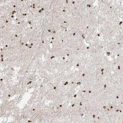 Immunohistochemistry-Paraffin: AFF4 Antibody [NBP1-89220]