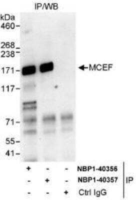 Immunoprecipitation: AFF4 Antibody [NBP1-40356]