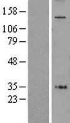 Western Blot: AFF4 Overexpression Lysate [NBL1-07373]