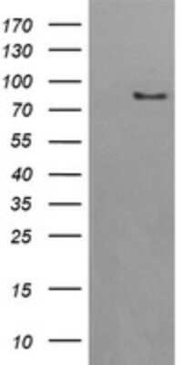 Western Blot: AFG3L2 Antibody (OTI4B6) [NBP2-45476]