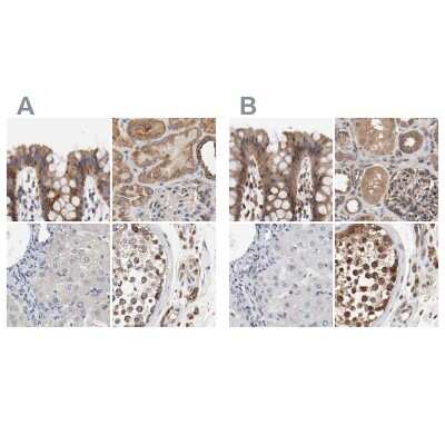 Immunohistochemistry-Paraffin: AFG3L2 Antibody [NBP1-87085]