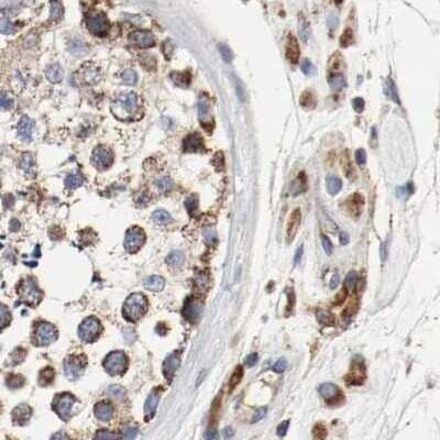 Immunohistochemistry-Paraffin: AFG3L2 Antibody [NBP1-87085]