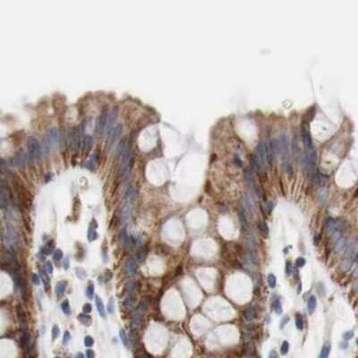 Immunohistochemistry-Paraffin: AFG3L2 Antibody [NBP1-87085]