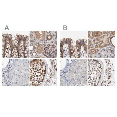 Immunohistochemistry-Paraffin: AFG3L2 Antibody [NBP1-87086]