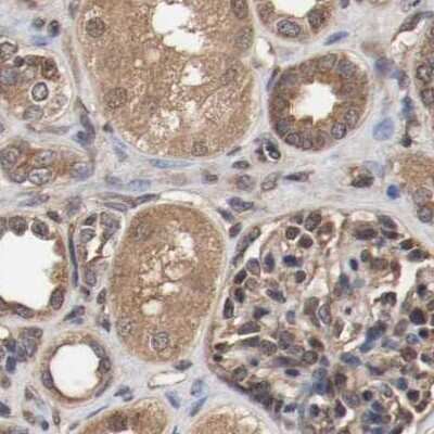 Immunohistochemistry-Paraffin: AFG3L2 Antibody [NBP1-87086]