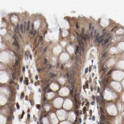 Immunohistochemistry-Paraffin: AFG3L2 Antibody [NBP1-87086]