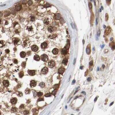 Immunohistochemistry-Paraffin: AFG3L2 Antibody [NBP1-87086]